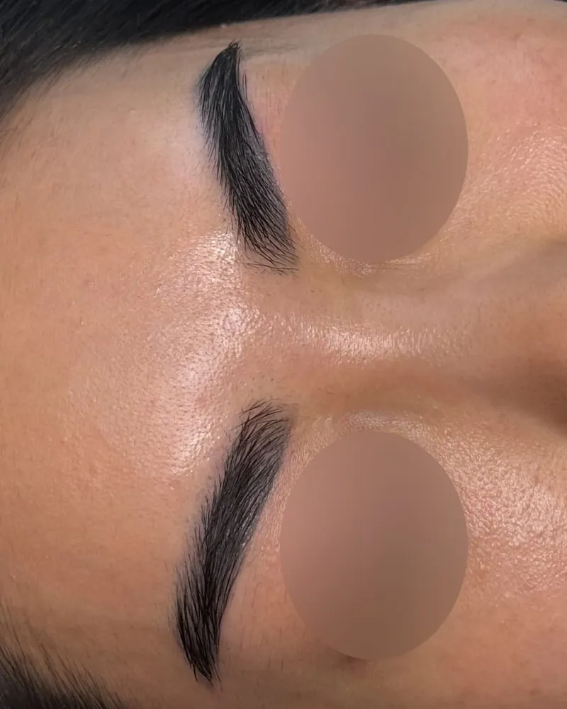 Permanent Makeup Removal before