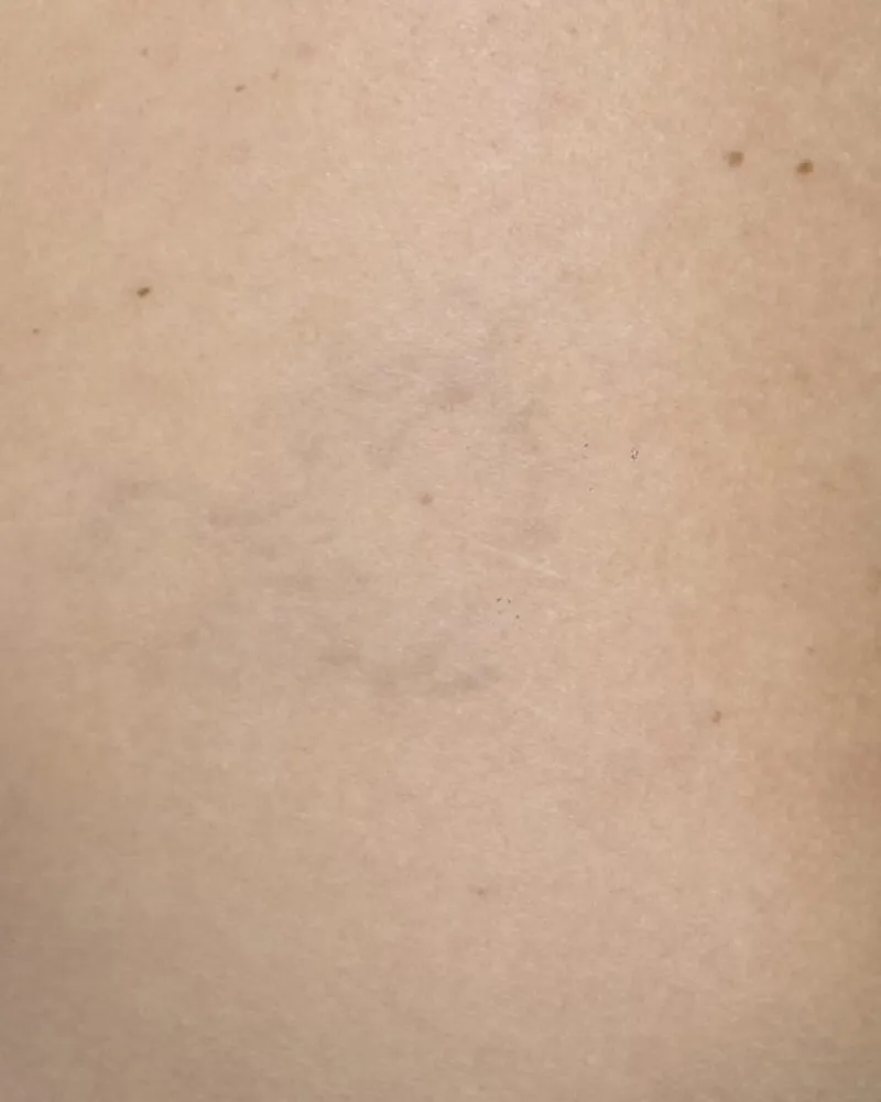 Tattoo Fading after