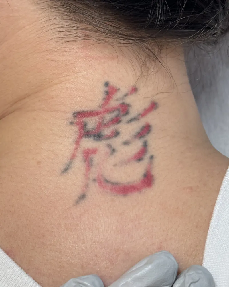 Tattoo Fading before